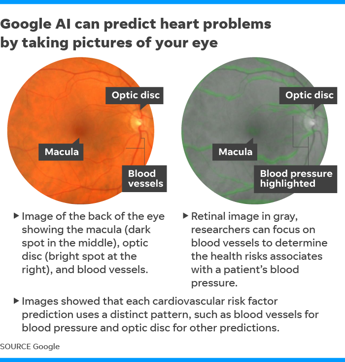 Google сможет прогнозировать сердечные заболевания, посмотрев вам в глаза [2]