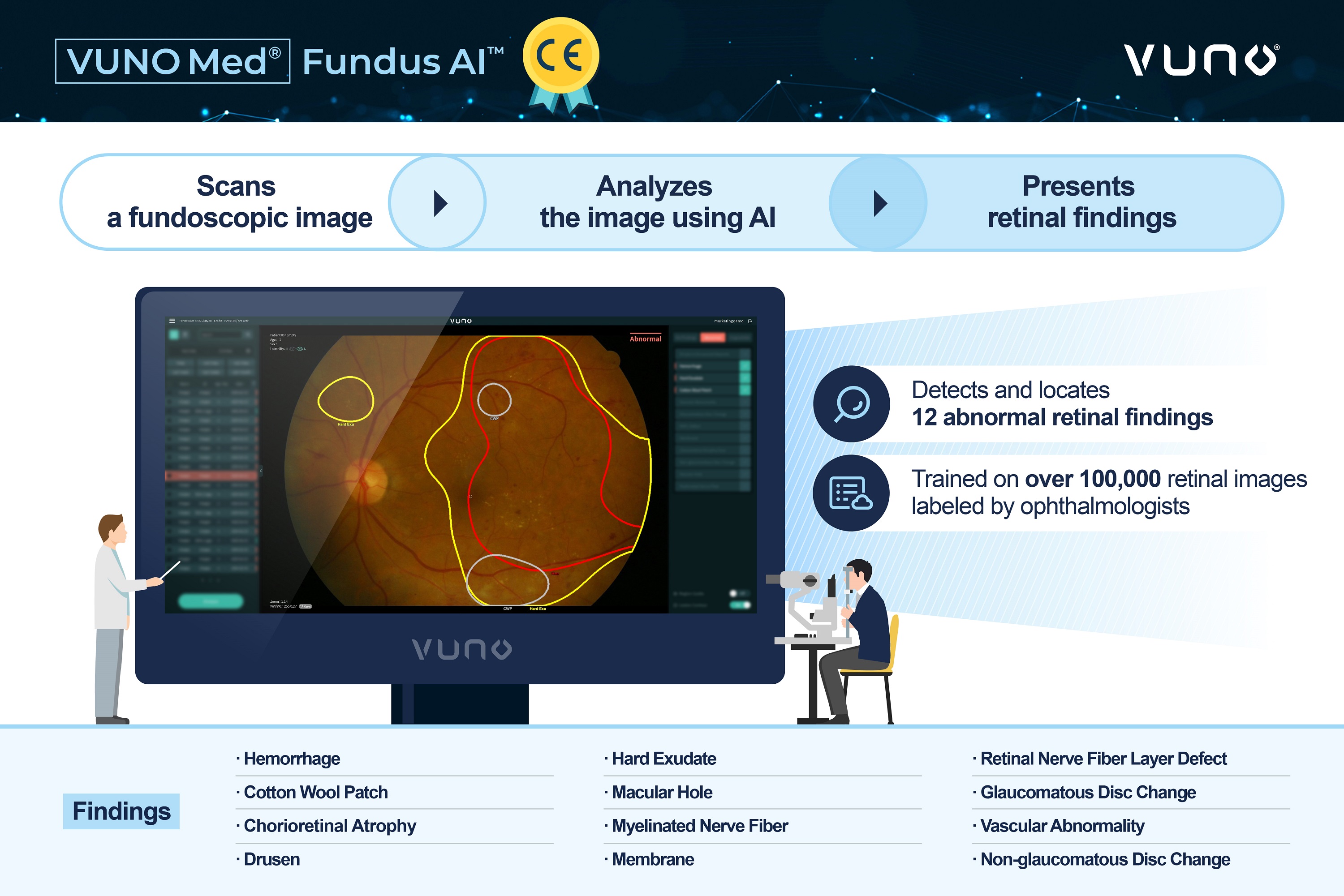 VUNO Med-Fundus-AI: инновационное решение для офтальмологического скрининга