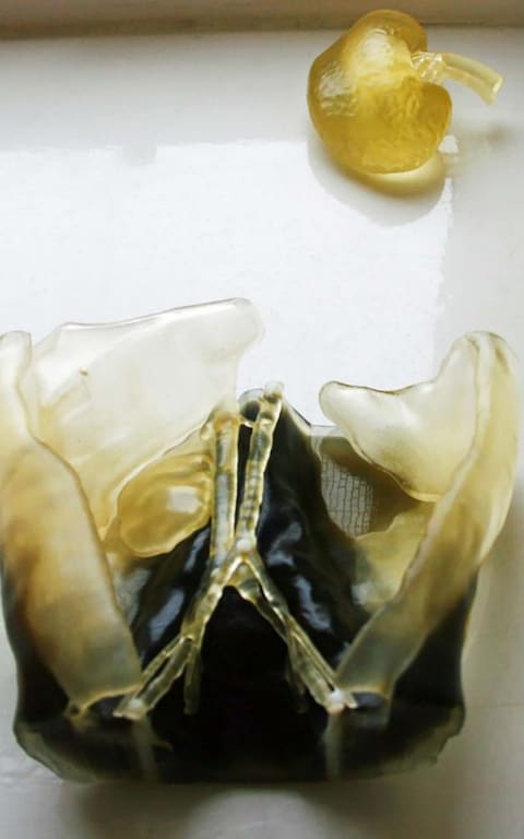 3D-модель почки и брюшной полости декстера Кларка