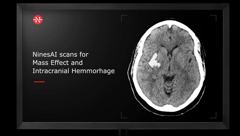 NinesAI: система автоматизированного анализа КТ-сканов головы с целью определения приоритетности обслуживания