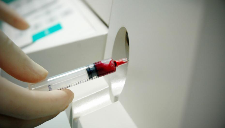 В России зарегистрировано новое дополнительное назначение теста на высокочувствительный тропонин-I для прогнозирования сердечно-сосудистого риска в амбулаторной практике