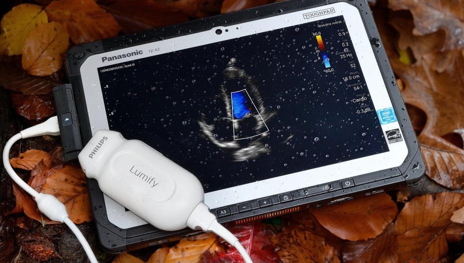 Портативный ультразвуковой аппарат Philips Lumify теперь позволяет производить измерения кровотока