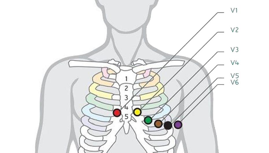 Разработка телеграм-бота для обучения основам ЭКГ