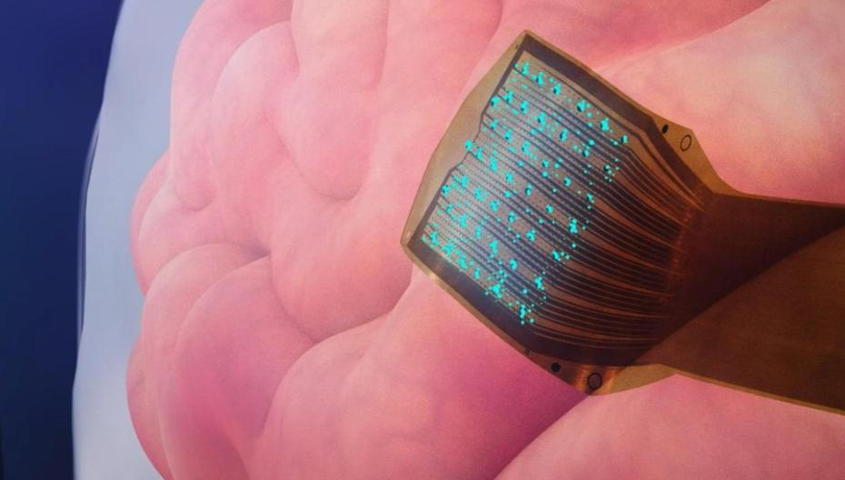 Как подключить мозг к компьютеру: нейроинтерфейсы нового поколения