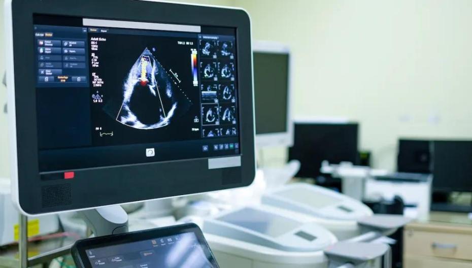 🎁 ИИ-модель в выявлении сердечной недостаточности