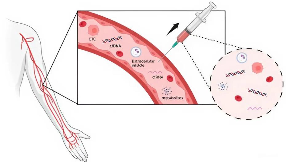 🩸 Жидкостная биопсия из одной капли крови может приблизить более раннюю и точную диагностику заболеваний