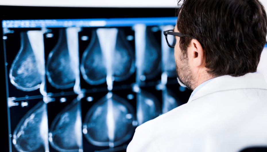 ProFound AI for 2D Mammography для диагностики рака груди