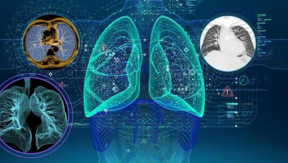 Союз для повышения качества радиологии: GE Healthcare, Intel и Nvidia