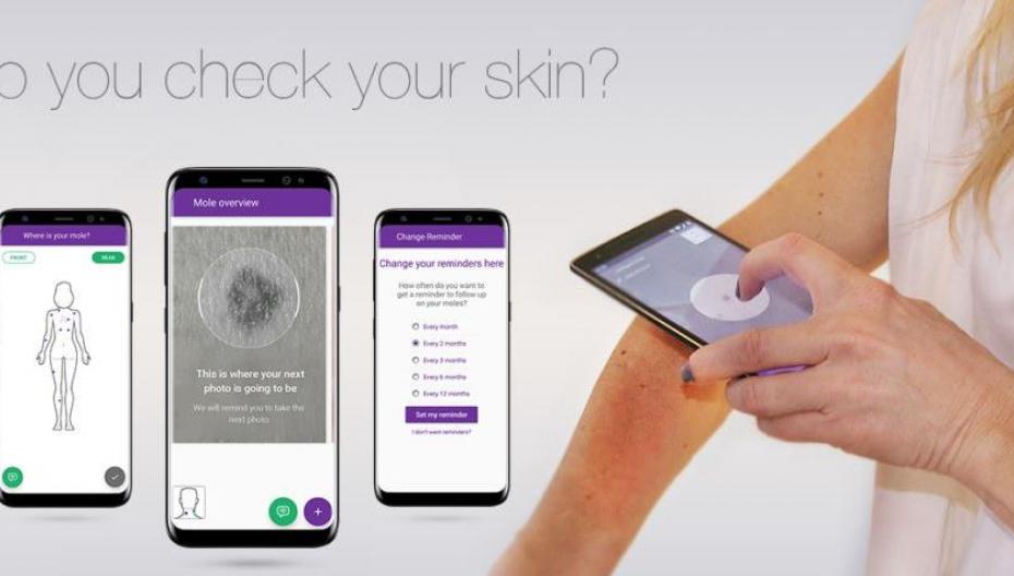 Дерматологическое приложение Miiskin получило поддержку British Skin Foundation