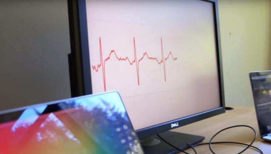 Алгоритм диагностирует аритмию как опытный кардиолог