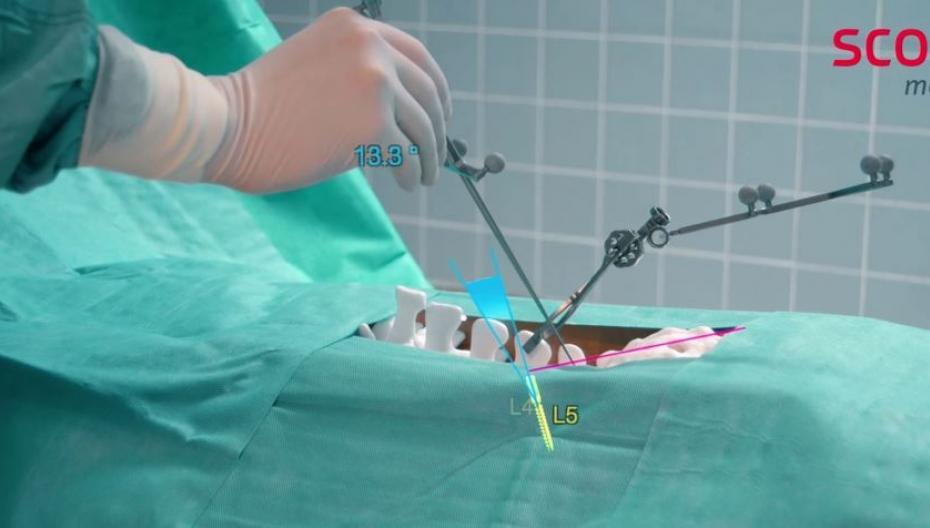 Microsoft HoloLens как ассистент при спинальной хирургии