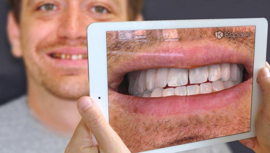 Как использовать дополненную реальность в стоматологии