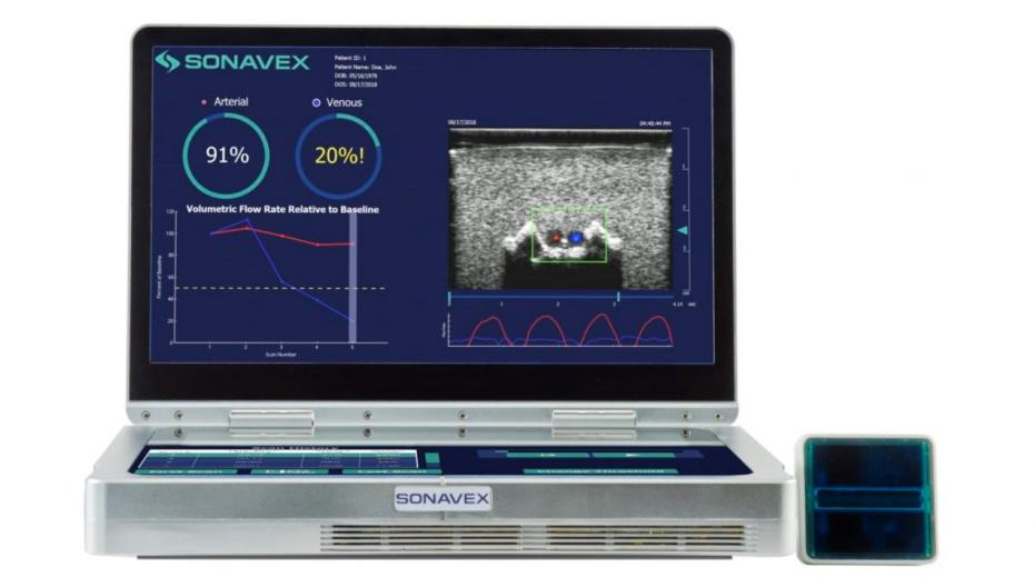 Sonavex EchoSure: ультразвуковой монитор кровотока