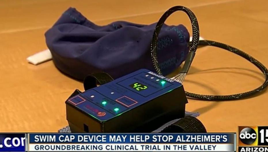 Медицинский прибор, который сможет остановить Альцгеймера