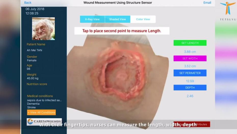 В Сингапуре разработали приложение для 3D-контроля лечения ран