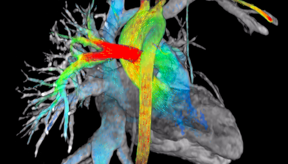 Приложение для визуализации потоков крови в сердце и вокруг него