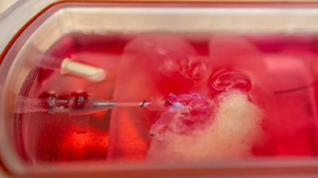 Ученые напечатали работающую миниатюрную человеческую печень