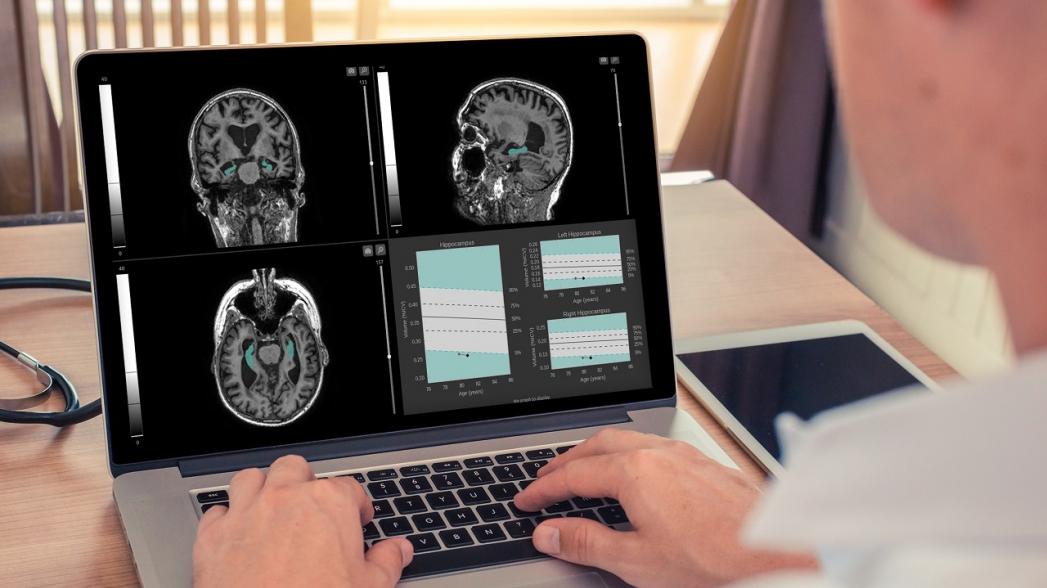 QyScore анализирует снимки МРТ для обнаружения признаков болезней мозга
