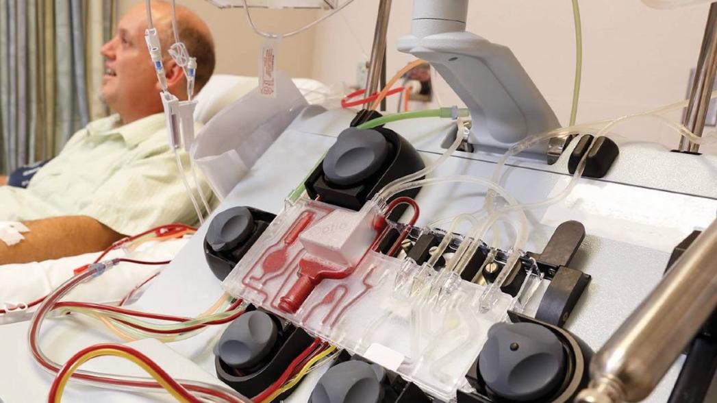 Портативные системы для очистки крови и диализа
