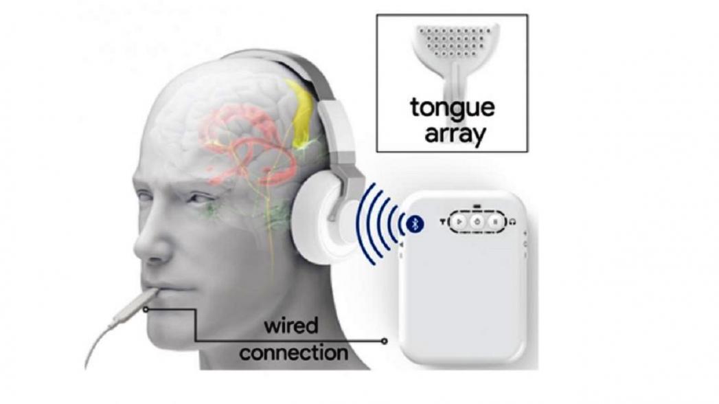 Электростимуляция языка и ушей как метод лечения звона в ушах