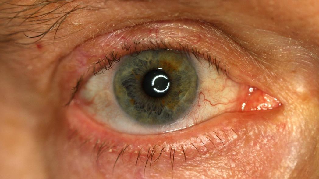 Разработан сканер для быстрой диагностики состояния глаз