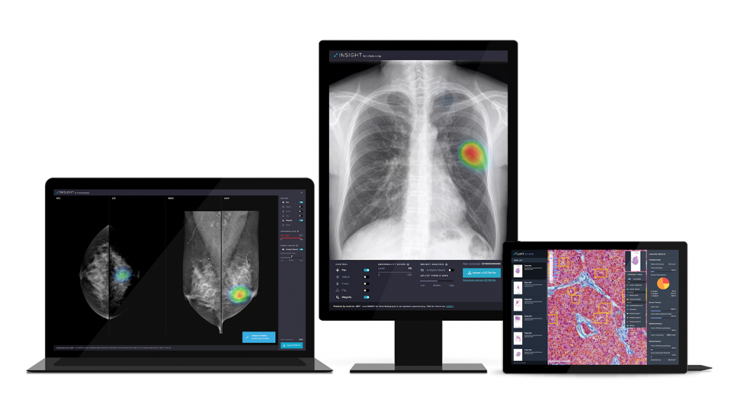 Philips и корейский стартап Lunit создают решение для быстрой диагностики по рентгеновским снимкам