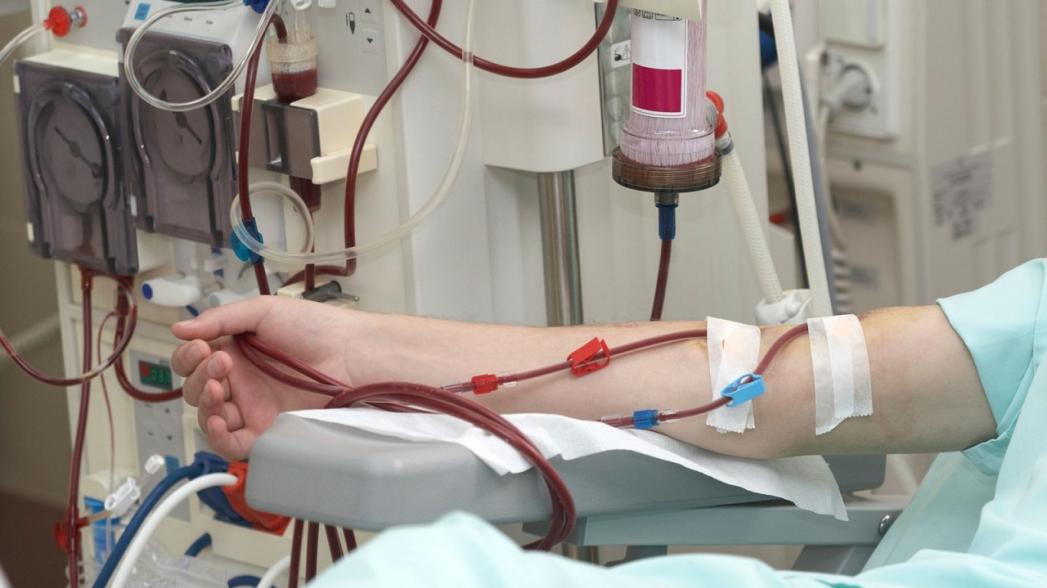 AI-система может помочь предотвратить анемию у пациентов, проходящих процедуру гемодиализа