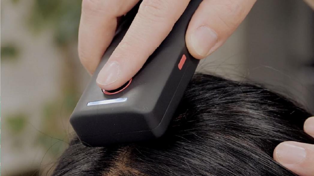 Сканер кожи головы помогает в домашних условиях справиться с выпадением волос