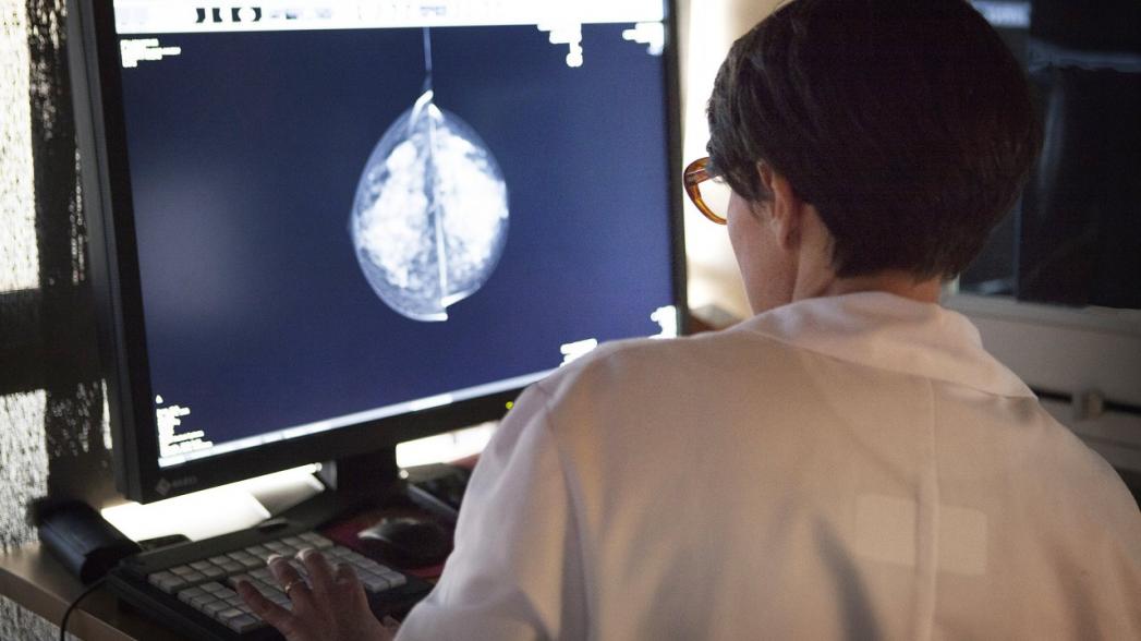 Великобритания: Применение систем на основе искусственного интеллекта может привести к избыточной диагностике рака груди