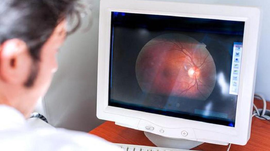 Искусственный интеллект предсказывает ежегодный риск сердечного приступа на основе сканирования сетчатки глаза