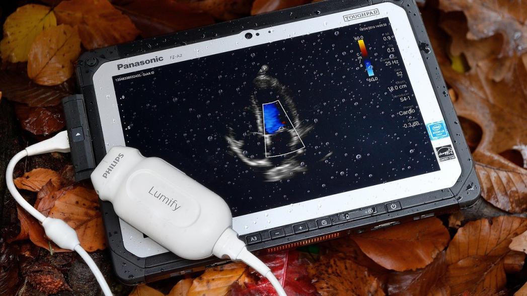 Портативный ультразвуковой аппарат Philips Lumify теперь позволяет производить измерения кровотока