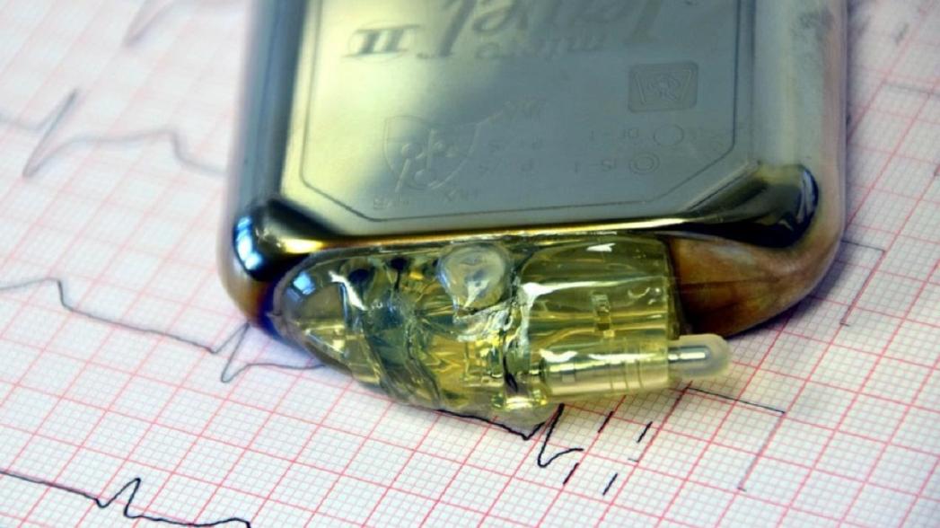 "Бионический" кардиостимулятор, способный обратить вспять сердечную недостаточность