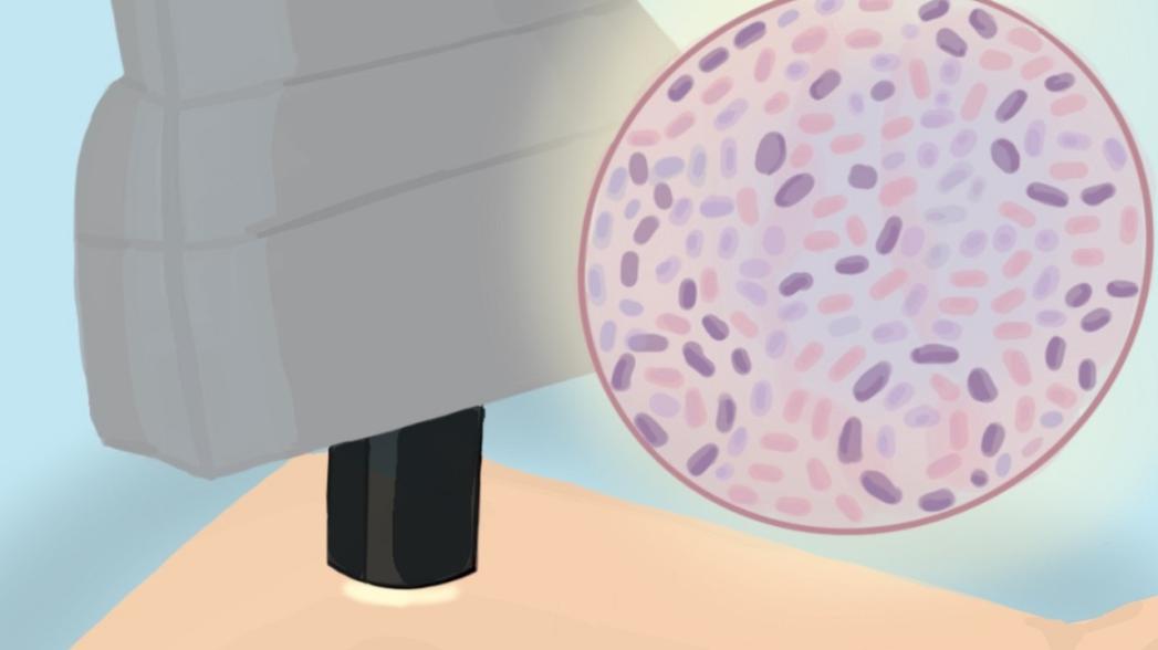 Новая технология "виртуальной гистологии" может уменьшить потребность в биопсии кожи