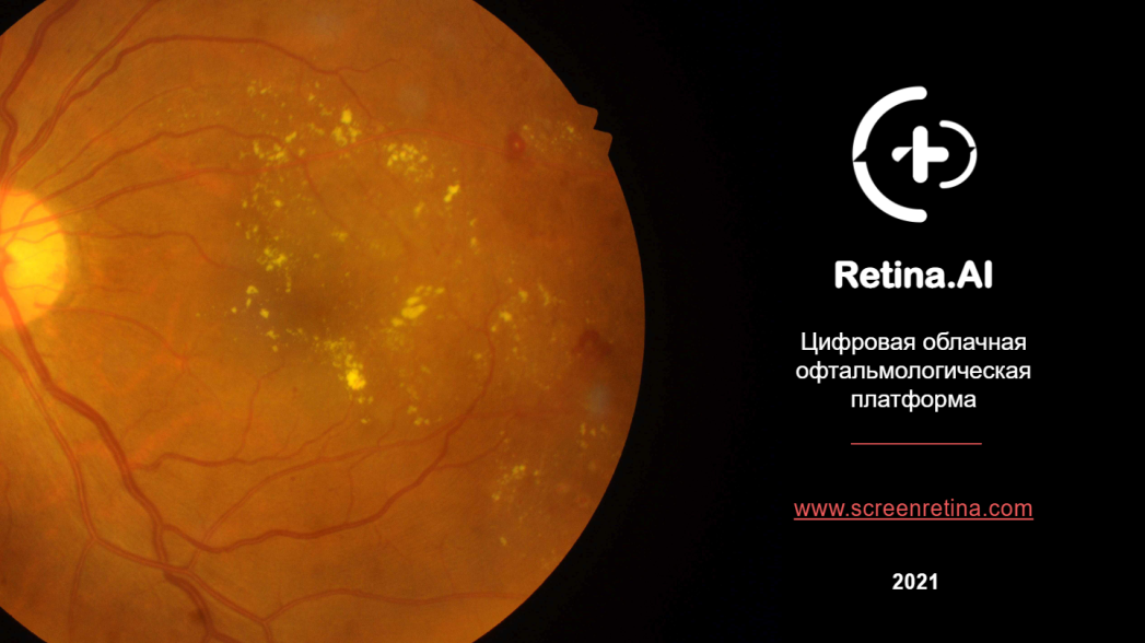 Retina.AI - Цифровая облачная офтальмологическая платформа