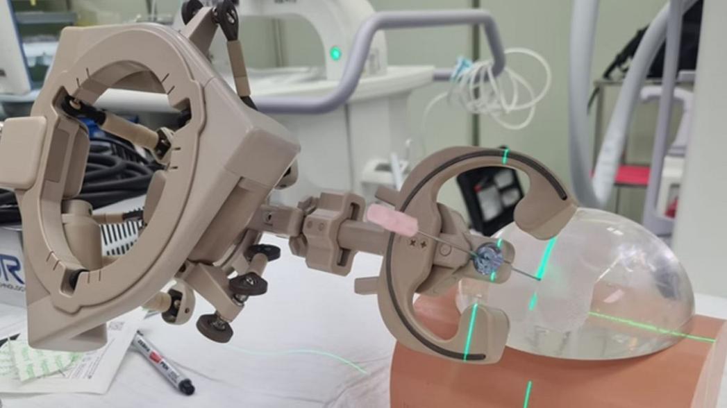 Автоматизация доступа к почкам при операции по удалению камней с помощью хирургического робота с искусственным интеллектом