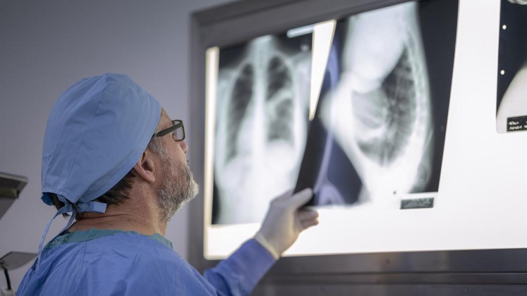 Искусственный интеллект может предсказать смерть от сердечных заболеваний по рентгену грудной клетки на 10 лет вперед