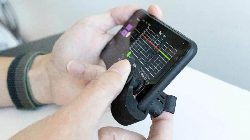 Сверхдешевая насадка для смартфона для контроля давления крови