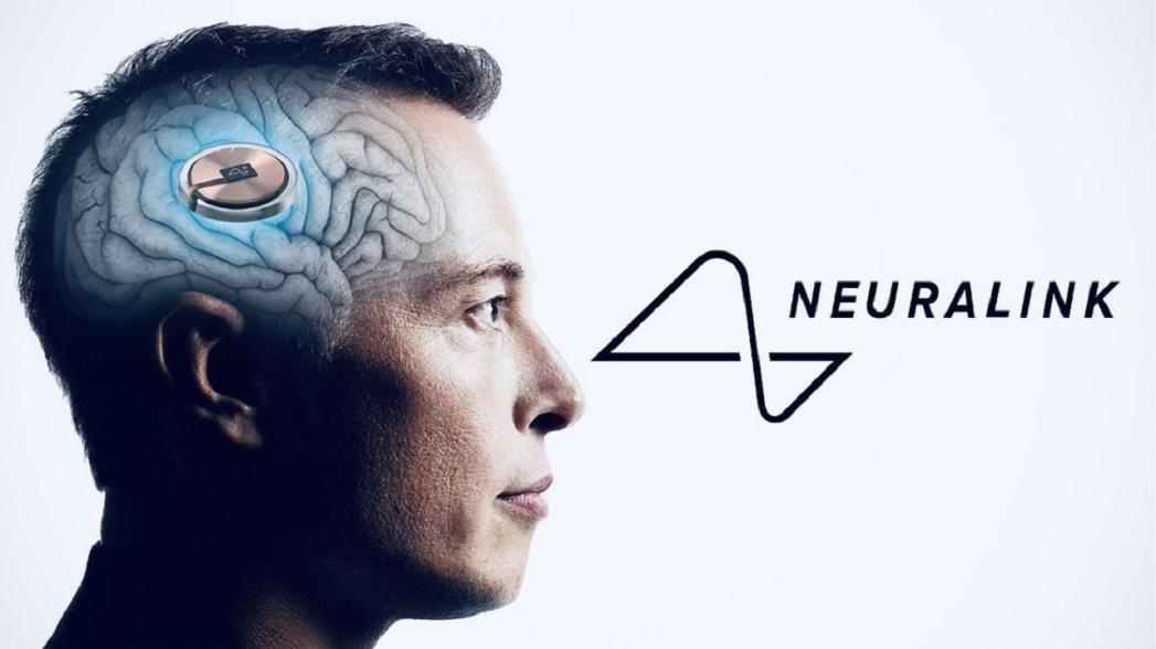 Компания Neuralink имплантировала интерфейс мозг-компьютер первому пациенту