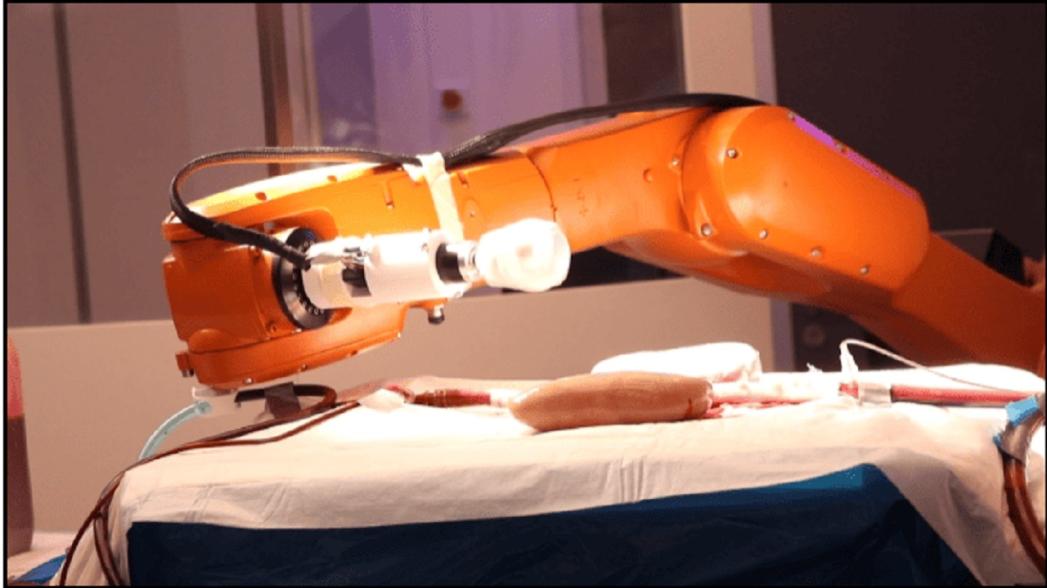 Миниатюрные роботы, способные плавать в артериях