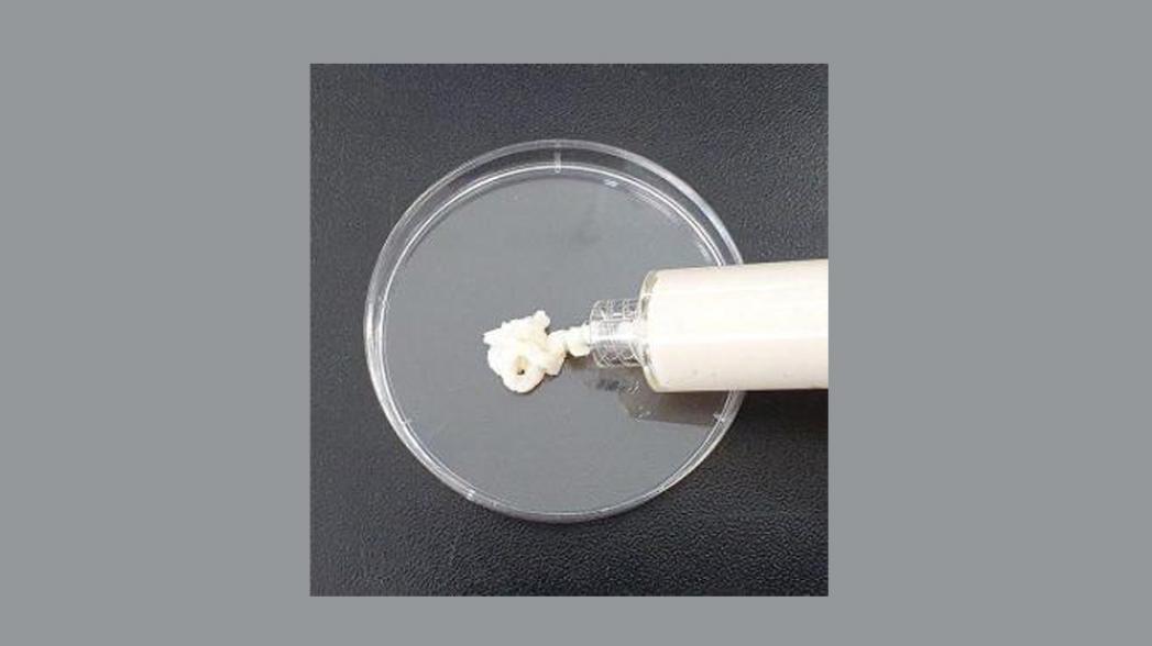 Инъекционный «имплантат» молочной железы как альтернатива традиционным операциям