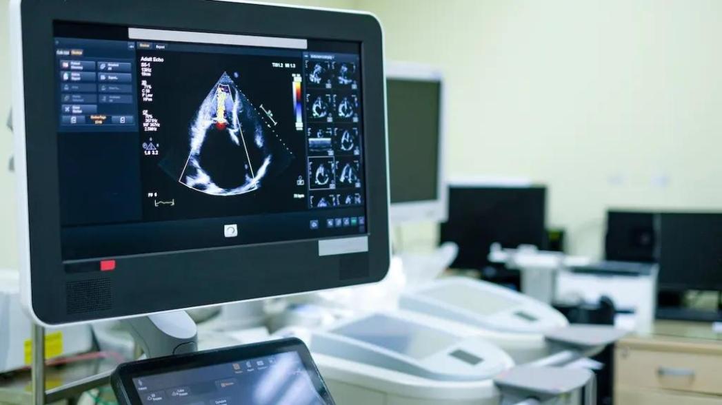 🎁 ИИ-модель в выявлении сердечной недостаточности