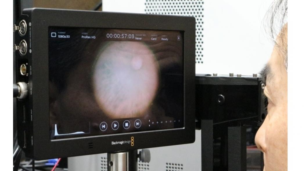Миниатюрная инфракрасная камера для диагностики глаз