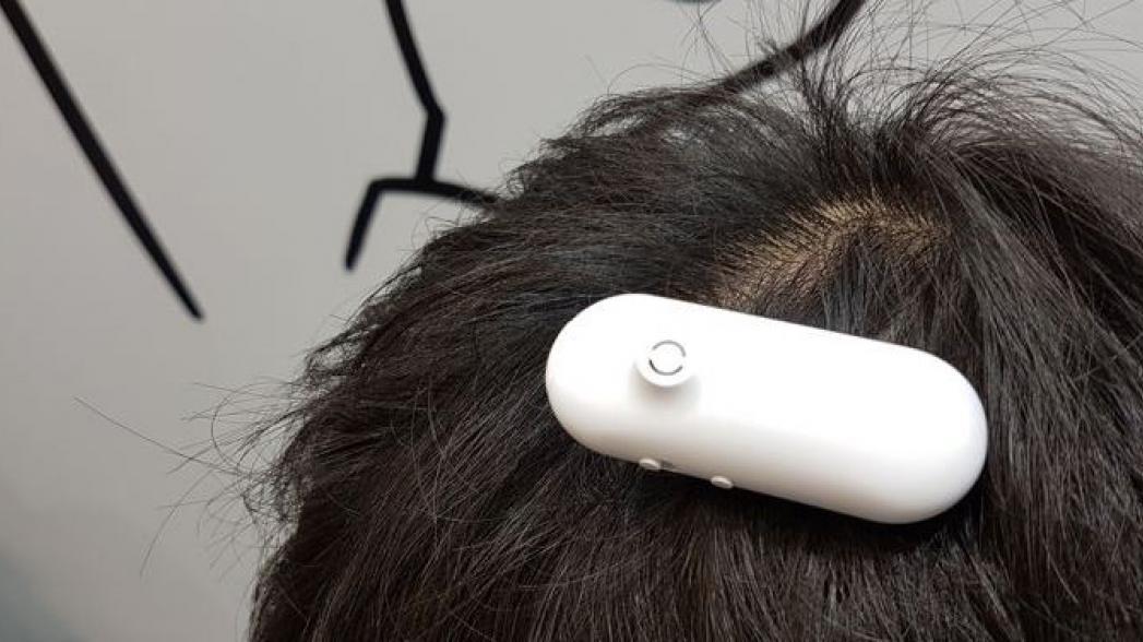 Клипса на волосах позволяет глухим людям чувствовать звуки