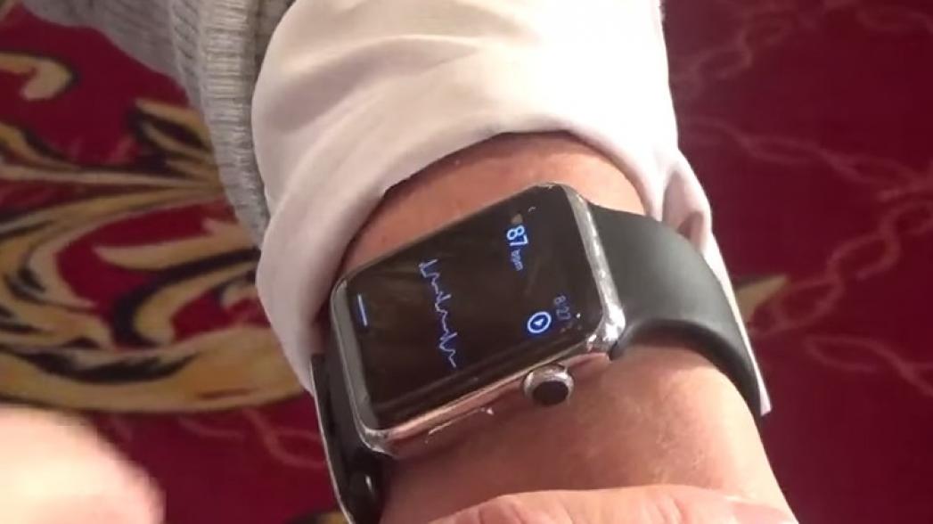 ЭКГ на Apple Watch от AliveCor