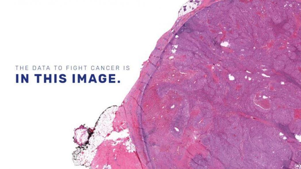 Proscia намерена закрыть технологическую "прореху" в исследованиях рака