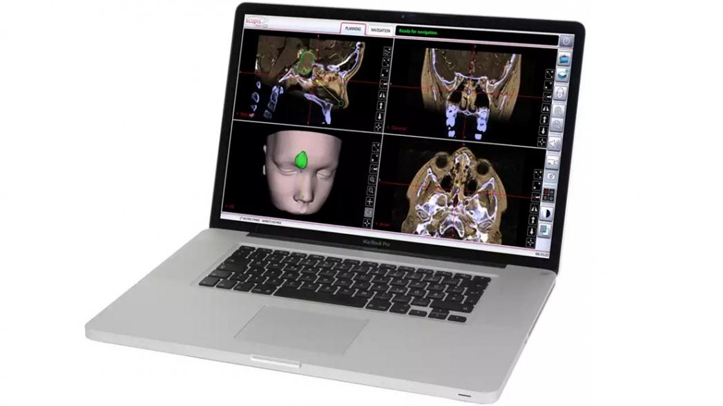Компьютерная система помогает хирургам при отоларингологических операциях