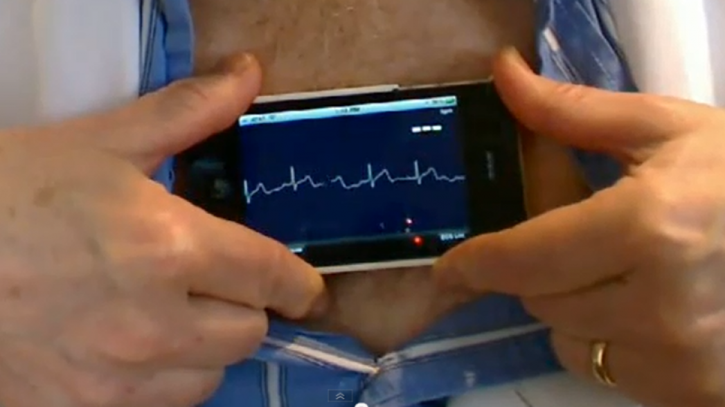 AliveCor разрабатывает очередной кардиологический инструмент на базе искусственного интеллекта