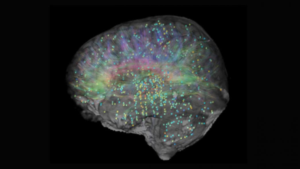 В человеческом мозге идентифицированы 32 модели проявления генов