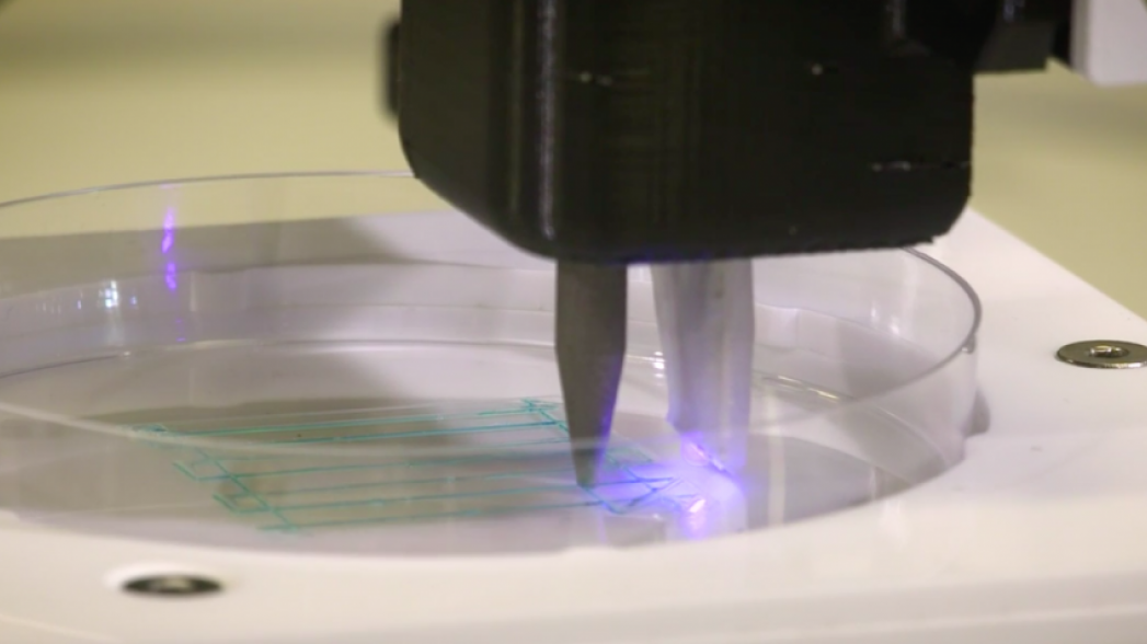 3D-принтер, который может революционизировать лечение диабета 1 типа