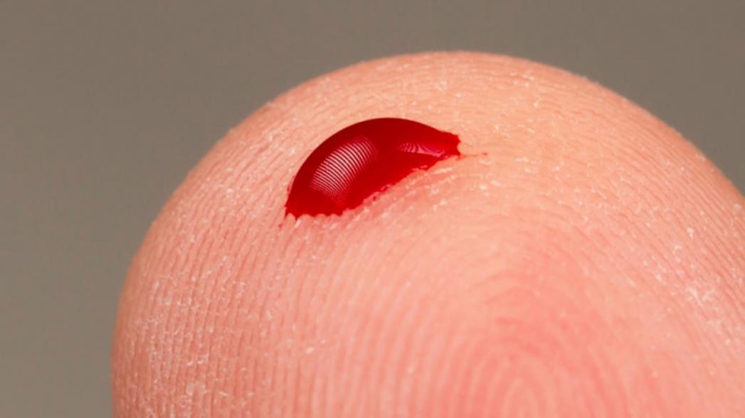 Пластырь с микроиглами для точного контроля уровня сахара в крови